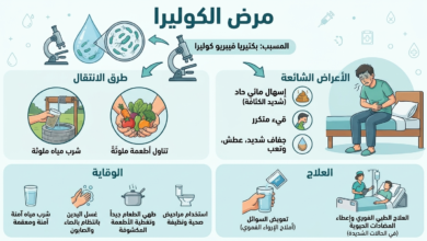 مرض الكوليرا